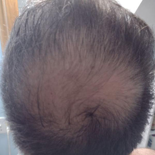 Before