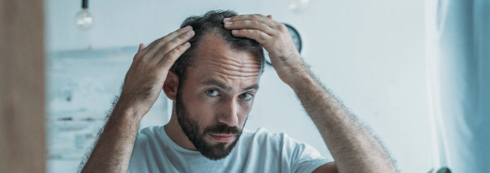 Man with light brown hair and beard wearing a t-shirt inspecting his hairline in the mirror.