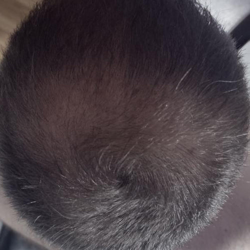 After