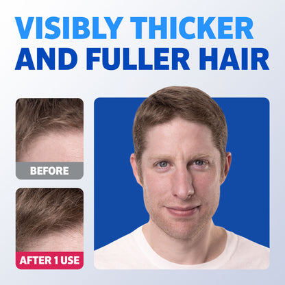 A before and after picture of a man with light brown hair showing visibly thicker and fuller hair.
