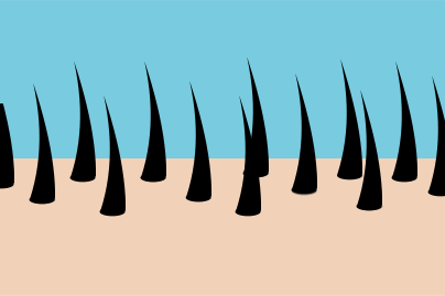 Illustration of scalp with new hair growth